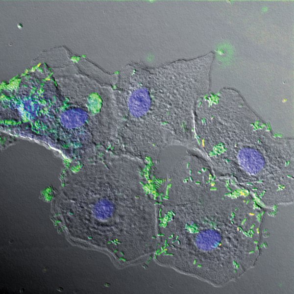 RHealth_Bacteria_MicroscopeImage_rp0117.jpg